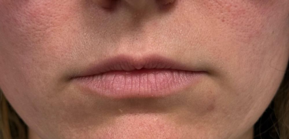 front pre lips_edit_crop_903_437