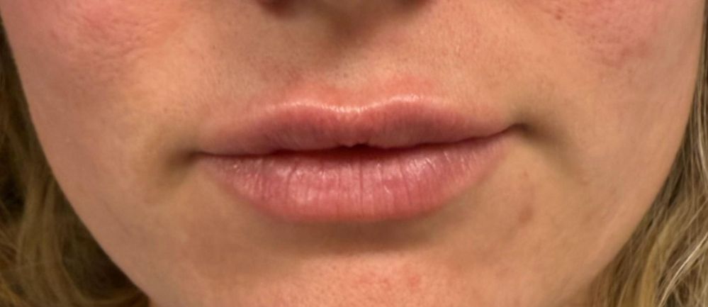front post lips_edit_crop_461_200