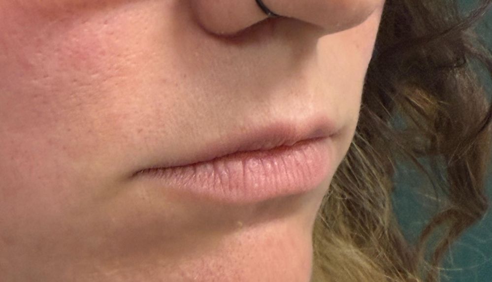 Pre lips_crop_622_357