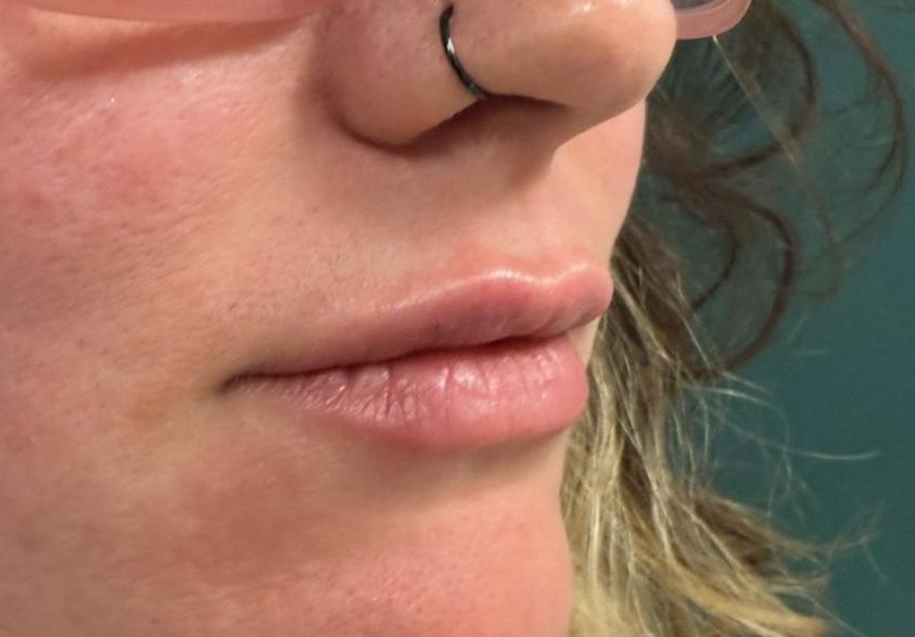 post lips_crop_639_445