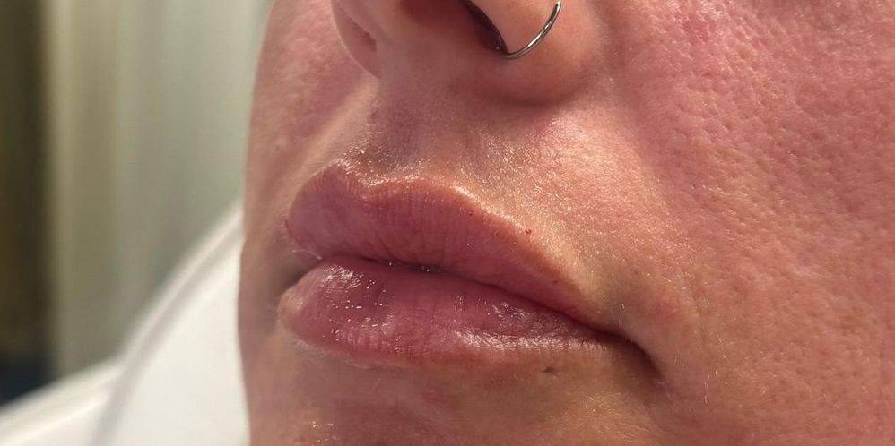 oblique lips_crop_957_477