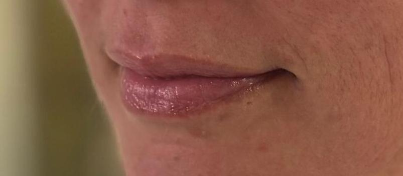 post lips oblique_crop_806_448_crop_755_331
